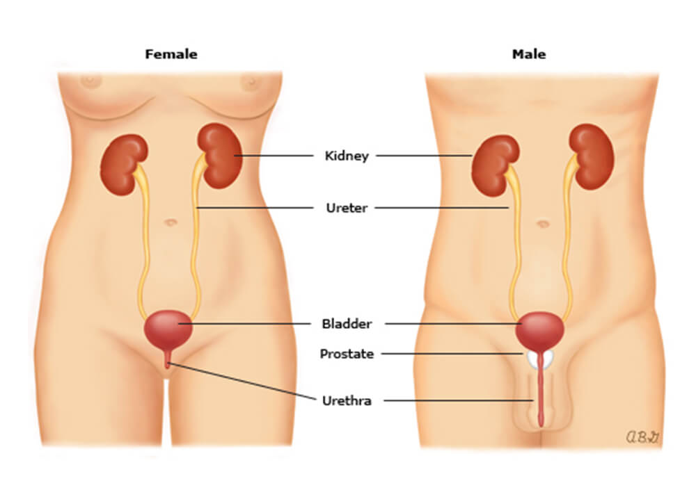 Hematuria Incontinence